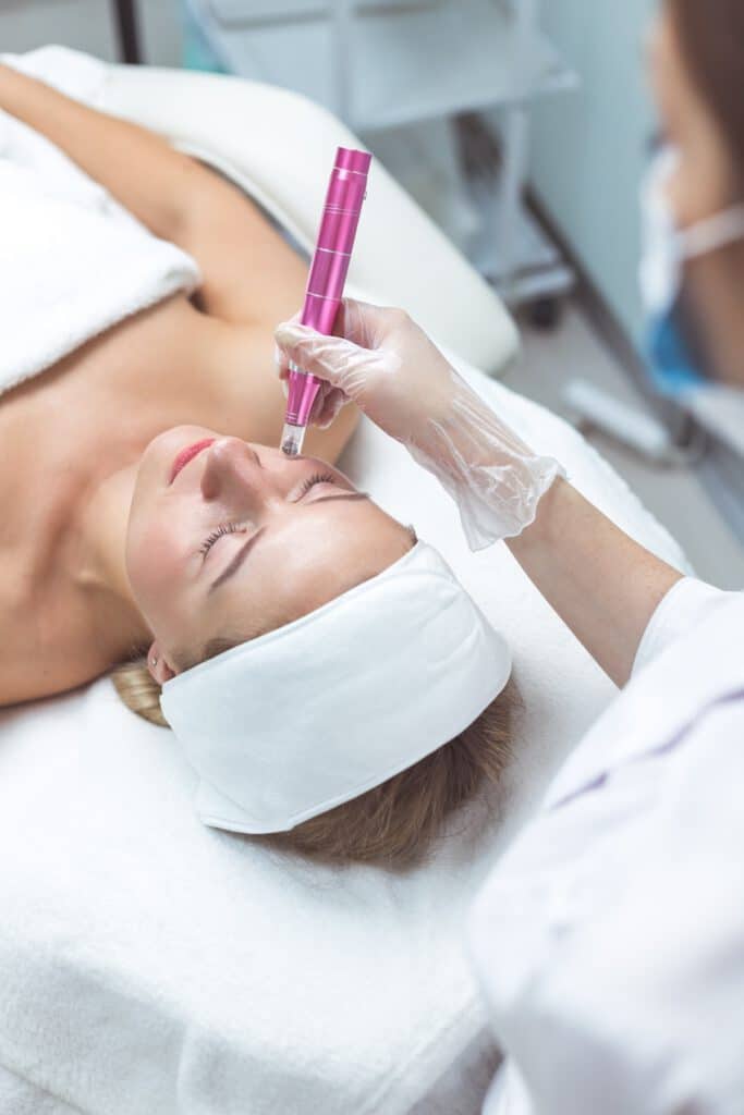 Eine Frau bei einer Microneedling Behandlung in Brügge